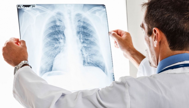 Servizio di radiografie a domicilio: quali sono i vantaggi?